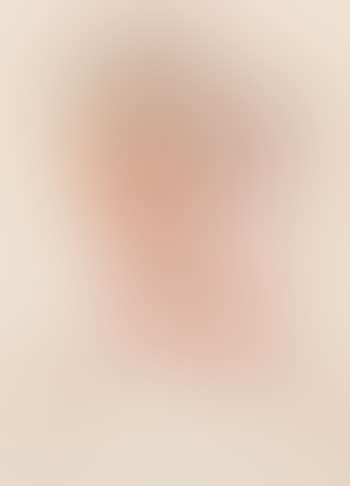 Red beard (preview)