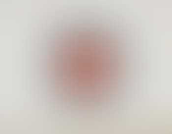 Joseph Beuys und die Medizin (preview)