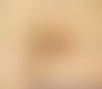 123 (preview)