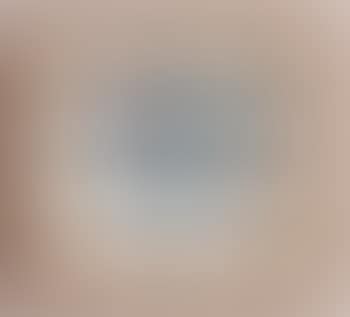 Figure (preview)