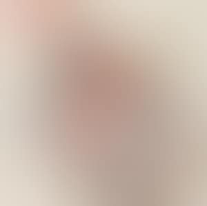 Figure (preview)