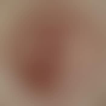 Abstraction (preview)