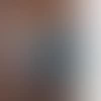 THE SCREAM, AFTER EDVARD MUNCH (PICTURE OF PIGMENTS) (preview)