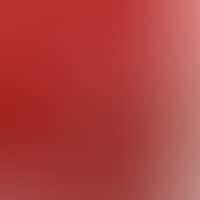 RED BLIND ONCLE N ° 2 (preview)