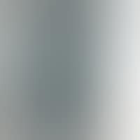 UNTITLED (NOSE) (preview)