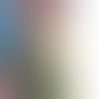 Composition (preview)