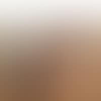 NU BASE BISTRE BASE (preview)