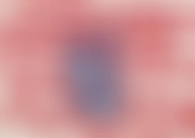 The Telephone Call from the Slammer (diptych), from What Is the Shape of This Problem? Series (preview)