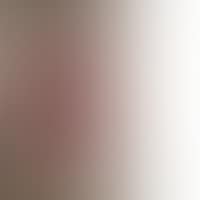UNTITLED (CIBORY AND CROSS) (preview)