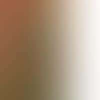 COMPOSITION (preview)