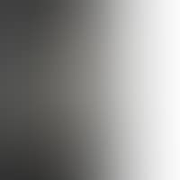 IN THE EXPECTATIVE (preview)