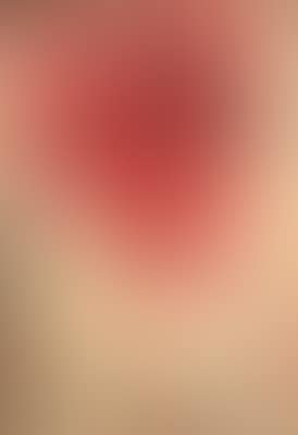 Sezione (preview)