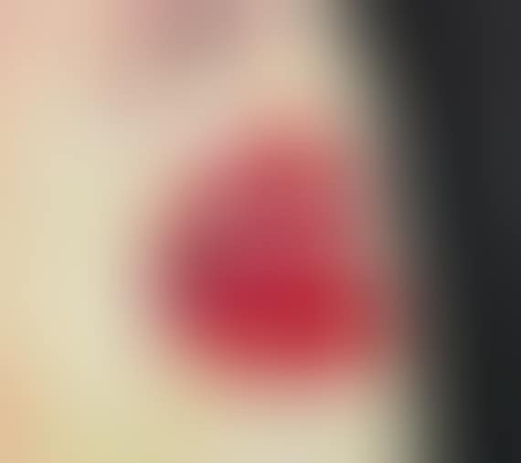 Mund V (preview)