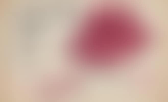 Cherries (preview)