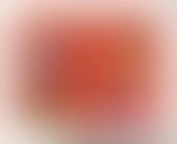 Bad finger , (preview)