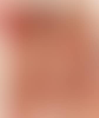 Relic of artistic action, accompanying a portfolio (?) (preview)