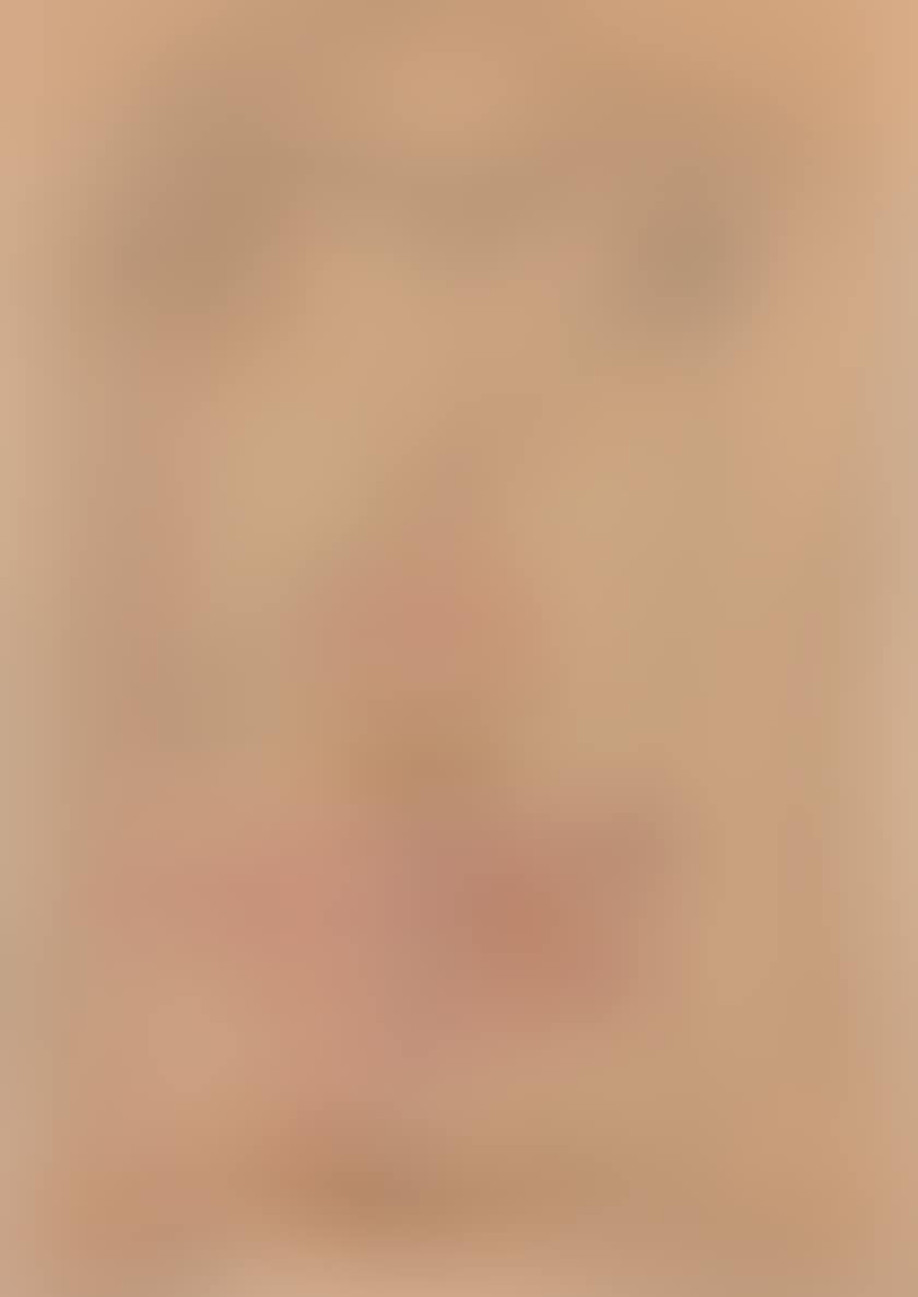 Head (preview)