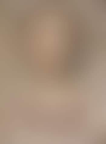 Figure (preview)