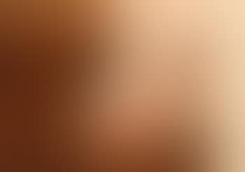 Man with spot (preview)