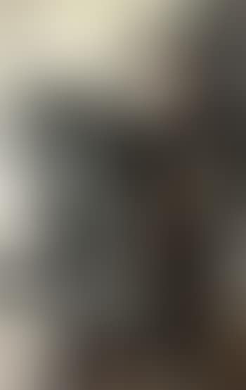 High cataract (preview)