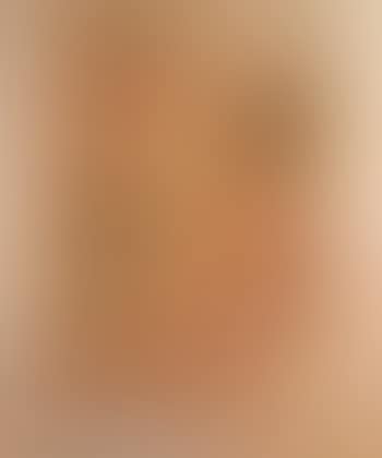 Figures (preview)