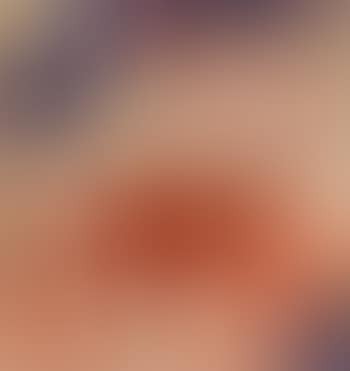 Tes (preview)
