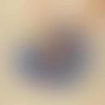 Fry (preview)