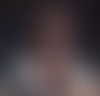 Head (preview)
