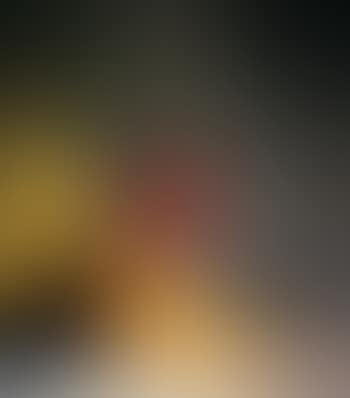 Scale on yellow and blue (preview)