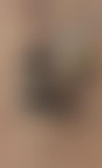 Concentric (preview)