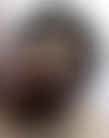 Adontoid pegs (preview)