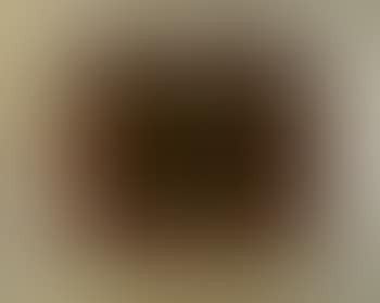 Vert syncope (preview)