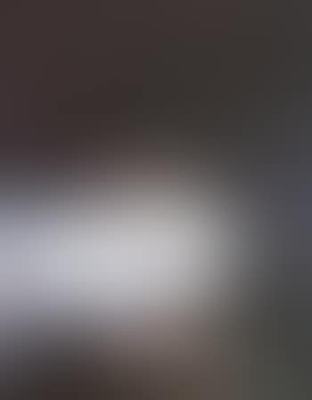 Tranenbeutel - tear sac (preview)
