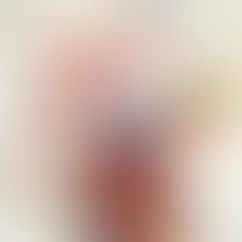 Disperser (preview)