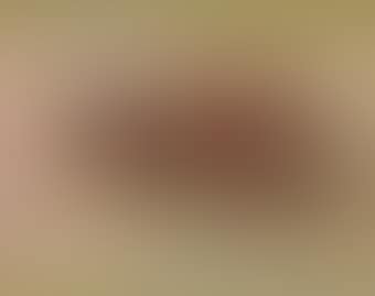 Erdbeeren (preview)