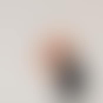 Radar rat (preview)