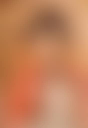 Adolescent (preview)