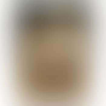 Self-portrait With A Black Eye (preview)