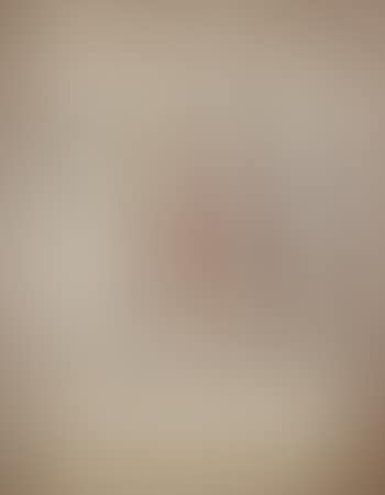 Figure (preview)