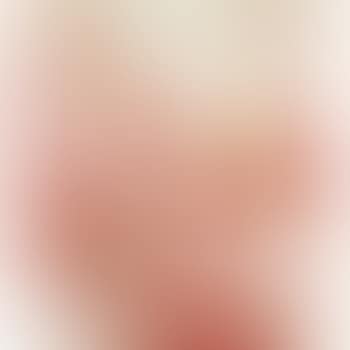 Einbruch (preview)