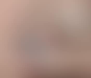 Anonyme (preview)