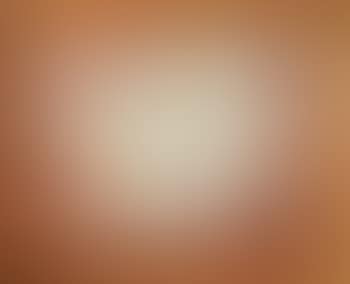 Androgynat II (preview)