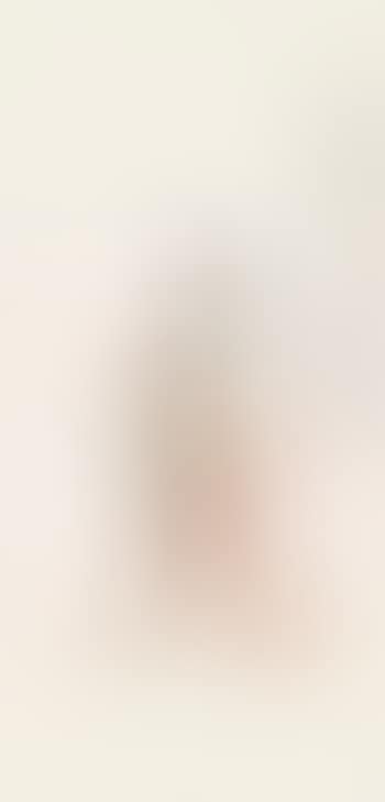 Figure (preview)