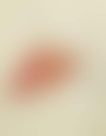 Untitled (anthurium) (preview)