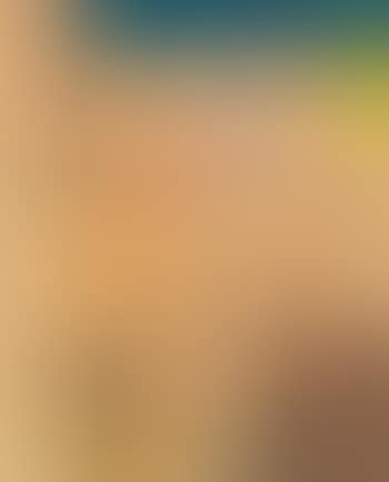 Spritze (Spray) (preview)