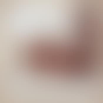 Fragment 31 (preview)