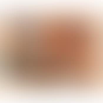 Sol Herido (preview)