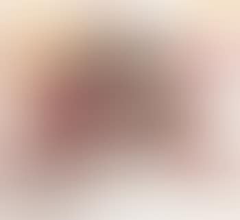 Landscape Patterns (preview)