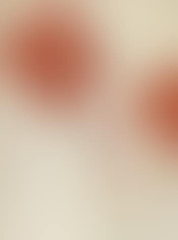 Rote Cannas (preview)