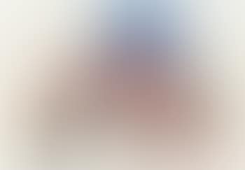 Figure (preview)